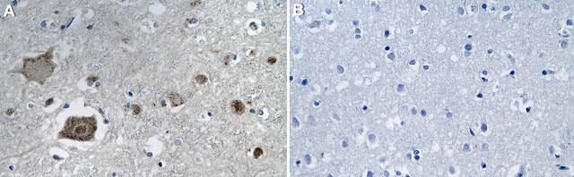 Anti-FGF-20 Antibody, clone 3I3-L2 ZooMAb&#174; Rabbit Monoclonal recombinant, expressed in HEK 293 cells