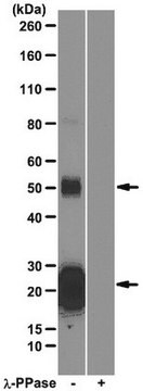 Anti-phospho TDP-43 (Ser409/Ser410) Antibody, clone 1D3 clone 1D3, from rat