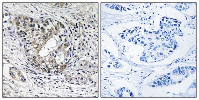 Anti-PNPT1 antibody produced in rabbit affinity isolated antibody