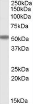 Anti-FOXC2 antibody produced in goat affinity isolated antibody, buffered aqueous solution