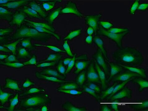 Anti-IFIT2 antibody produced in rabbit purified immunoglobulin, buffered aqueous solution