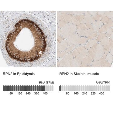 Anti-RPN2 antibody produced in rabbit Prestige Antibodies&#174; Powered by Atlas Antibodies, affinity isolated antibody, buffered aqueous glycerol solution