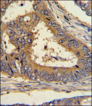 ANTI-SCAP (CENTER) antibody produced in rabbit IgG fraction of antiserum, buffered aqueous solution