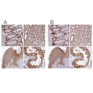 Anti-WDR61 antibody produced in rabbit Prestige Antibodies&#174; Powered by Atlas Antibodies, affinity isolated antibody, buffered aqueous glycerol solution