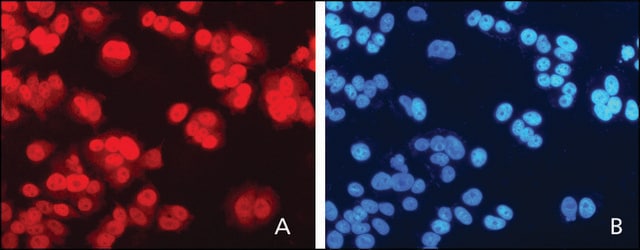 Anti-XPC (C-terminal) antibody produced in rabbit ~1&#160;mg/mL, affinity isolated antibody, buffered aqueous solution