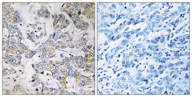 Anti-RPL37 antibody produced in rabbit affinity isolated antibody