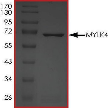 MYLK4, Active PRECISIO&#174; Kinase, recombinant