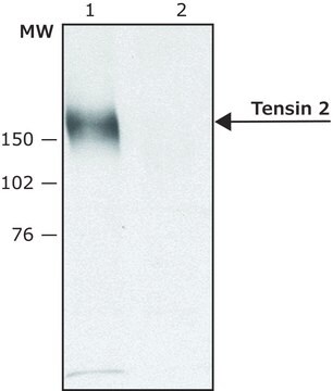 Anti-Tensin 2 (C-terminal) antibody produced in rabbit affinity isolated antibody