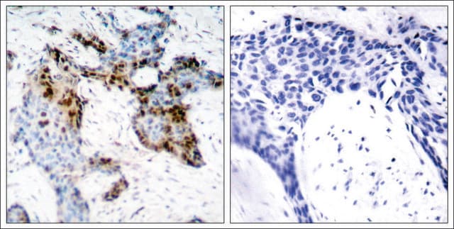 Anti-ESR1 (Ab-118) antibody produced in rabbit affinity isolated antibody