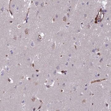 Anti-C15orf59 antibody produced in rabbit Prestige Antibodies&#174; Powered by Atlas Antibodies, affinity isolated antibody, buffered aqueous glycerol solution