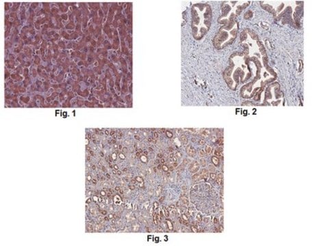 Anti-Catechol O-methyltransferase/COMT Antibody from rabbit, purified by affinity chromatography