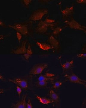 Anti-TYMS antibody produced in rabbit