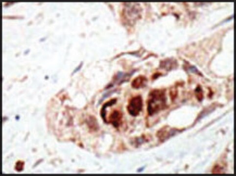 Anti-UBA2 (N-term) antibody produced in rabbit IgG fraction of antiserum, buffered aqueous solution