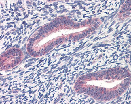 Anti-TWIST1 IgG fraction of antiserum