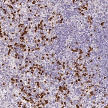 Anti-RCAN2 antibody produced in rabbit Prestige Antibodies&#174; Powered by Atlas Antibodies, affinity isolated antibody, buffered aqueous glycerol solution