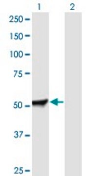 Anti-PFKFB2 antibody produced in mouse purified immunoglobulin, buffered aqueous solution