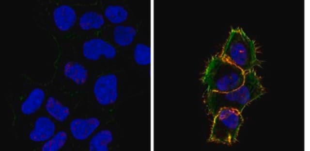 Anti-phospho-EGFR (Tyr1173) Antibody, clone 3E7.2 clone 3E7.2, from mouse