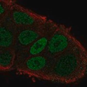 Anti-MYO6 antibody produced in rabbit Prestige Antibodies&#174; Powered by Atlas Antibodies, affinity isolated antibody, buffered aqueous glycerol solution