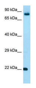 Anti-FGF18 (C-terminal) antibody produced in rabbit affinity isolated antibody