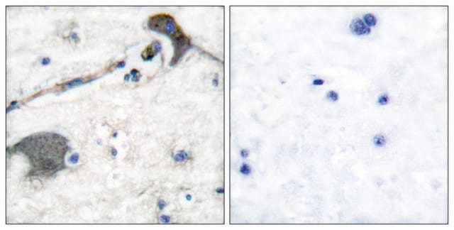 Anti-RASH antibody produced in rabbit affinity isolated antibody