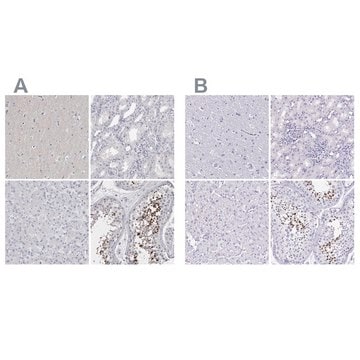 Anti-SPACA1 antibody produced in rabbit Prestige Antibodies&#174; Powered by Atlas Antibodies, affinity isolated antibody, buffered aqueous glycerol solution