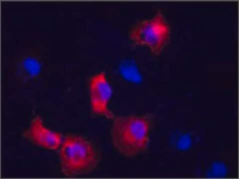 Anti-VIM affinity isolated antibody