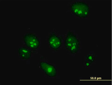 Anti-ABT1 antibody produced in mouse purified immunoglobulin, buffered aqueous solution