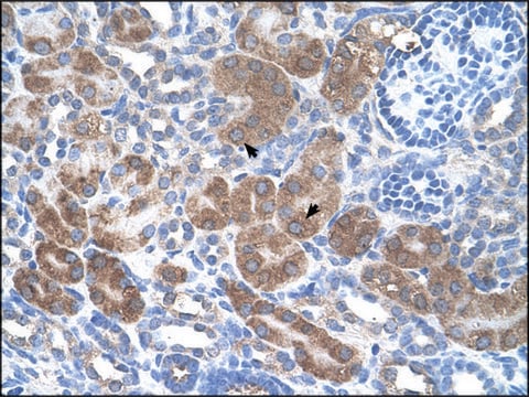 Anti-CD36 antibody produced in rabbit affinity isolated antibody