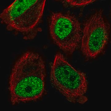 Anti-ABHD8 antibody produced in rabbit Prestige Antibodies&#174; Powered by Atlas Antibodies, affinity isolated antibody