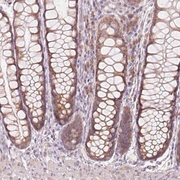 Anti-BLOC1S2 antibody produced in rabbit Prestige Antibodies&#174; Powered by Atlas Antibodies, affinity isolated antibody, buffered aqueous glycerol solution