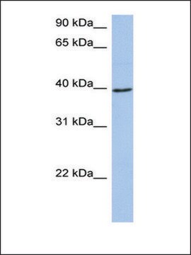 Anti-ACADM antibody produced in rabbit affinity isolated antibody