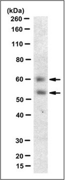 Anti-Myocilin (NT) Antibody, clone 7.1 clone 7.1, from mouse