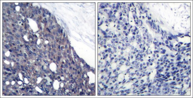 Anti-NFKBIA (Ab-42) antibody produced in rabbit affinity isolated antibody