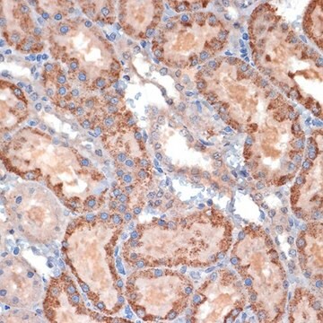 Anti-TIMM50 antibody produced in rabbit