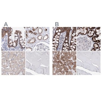 Anti-HIBCH antibody produced in rabbit Prestige Antibodies&#174; Powered by Atlas Antibodies, affinity isolated antibody, buffered aqueous glycerol solution