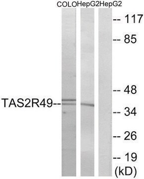 Anti-TAS2R49 antibody produced in rabbit affinity isolated antibody