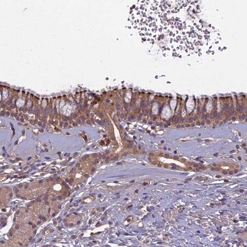 Anti-CCDC167 antibody produced in rabbit Prestige Antibodies&#174; Powered by Atlas Antibodies, affinity isolated antibody, buffered aqueous glycerol solution