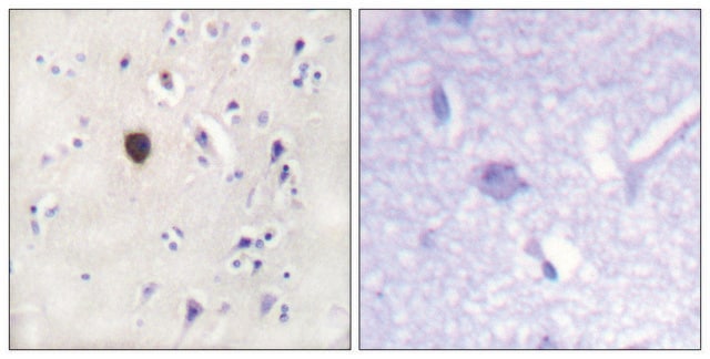 Anti-KIR6.2 antibody produced in rabbit affinity isolated antibody