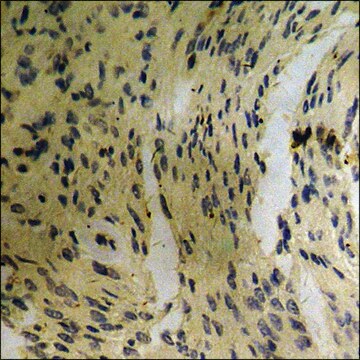 Anti-phospho-EGFR (pSer1070) antibody produced in rabbit affinity isolated antibody