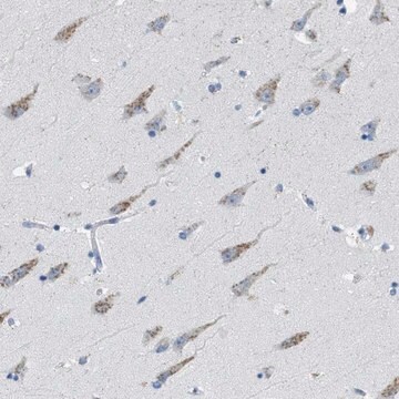 Anti-WBSCR17 antibody produced in rabbit Prestige Antibodies&#174; Powered by Atlas Antibodies, affinity isolated antibody, buffered aqueous glycerol solution