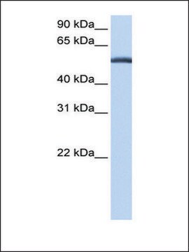 Anti-LACTB (AB2) antibody produced in rabbit affinity isolated antibody