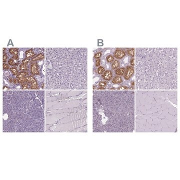 Anti-CLIC4 antibody produced in rabbit Prestige Antibodies&#174; Powered by Atlas Antibodies, affinity isolated antibody, buffered aqueous glycerol solution