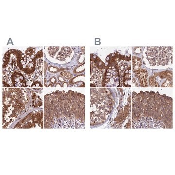 Anti-MKKS antibody produced in rabbit Prestige Antibodies&#174; Powered by Atlas Antibodies, affinity isolated antibody, buffered aqueous glycerol solution