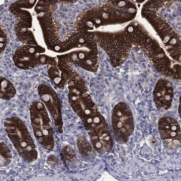 Anti-Ces2 Antibody Produced In Rabbit Prestige Antibodies&#174; Powered by Atlas Antibodies, affinity isolated antibody, buffered aqueous glycerol solution