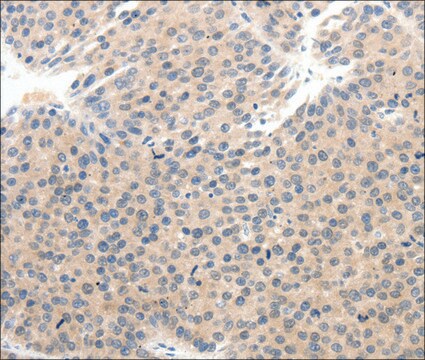 Anti-SCN10A antibody produced in rabbit affinity isolated antibody