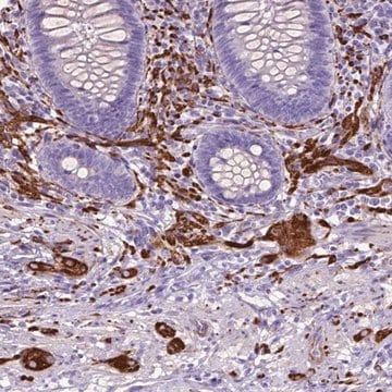 Anti-MAPT antibody produced in rabbit Prestige Antibodies&#174; Powered by Atlas Antibodies, affinity isolated antibody, buffered aqueous glycerol solution