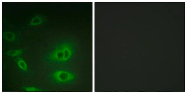 Anti-ATP1 &#945; antibody produced in rabbit affinity isolated antibody