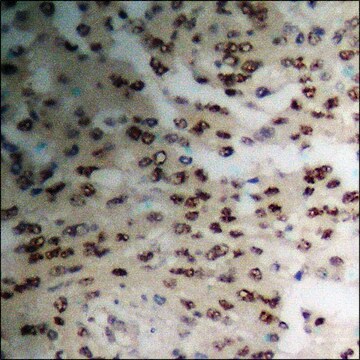 抗-磷酸-TIE2 (pTyr1108) 兔抗 affinity isolated antibody