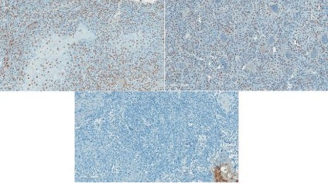 Anti-Histone H3 Antibody, K36M mutant from rabbit, purified by affinity chromatography