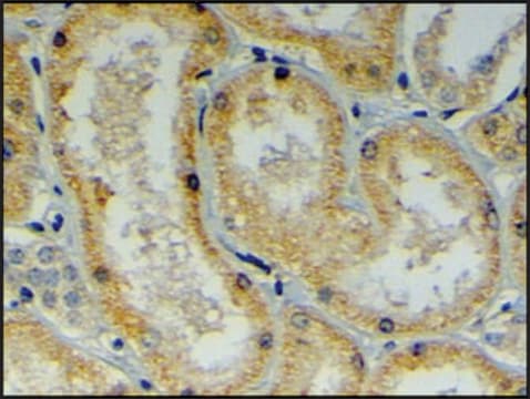 Anti-DNAJB9 (C-terminal) antibody produced in goat affinity isolated antibody, buffered aqueous solution